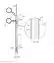 Fig. 16 - Obesity treatment systems