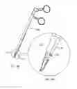 Fig. 17 - Obesity treatment systems