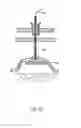 Fig. 23 - Obesity treatment systems