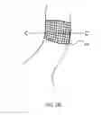 Fig. 34 - Obesity treatment systems