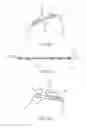 Fig. 51 - Obesity treatment systems