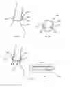 Fig. 56 - Obesity treatment systems