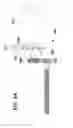 Fig. 07 - OPTICAL DETECTION OF MEDICAL PUMP ROTOR POSITION