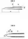 Fig. 05 - Indwelling needle assembly