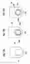 Fig. 11 - Indwelling needle assembly