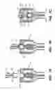 Fig. 08 - Catheter with Removable Extension