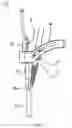 Fig. 06 - Bone milling instrument