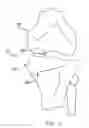 Fig. 02 - Method and apparatus for performing an open wedge, high tibial osteotomy