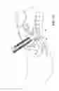 Fig. 08 - Endoscopic balloon tissue dissector and retractor