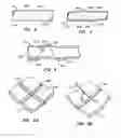 Fig. 04 - Endoluminal Filter With Fixation