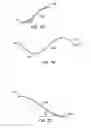 Fig. 06 - Endoluminal Filter With Fixation