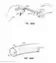 Fig. 34 - Endoluminal Filter With Fixation