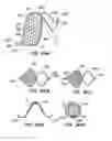 Fig. 48 - Endoluminal Filter With Fixation