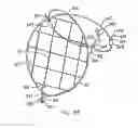 Fig. 52 - Endoluminal Filter With Fixation