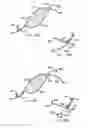Fig. 53 - Endoluminal Filter With Fixation