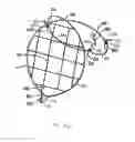 Fig. 55 - Endoluminal Filter With Fixation