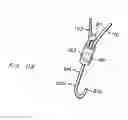 Fig. 63 - Endoluminal Filter With Fixation