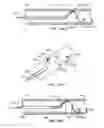 Fig. 65 - Endoluminal Filter With Fixation