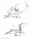Fig. 67 - Endoluminal Filter With Fixation