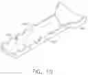 Fig. 10 - Stomach invagination method and apparatus