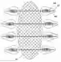 Fig. 01 - Clinical and surgical system and method for moving and stretching plastic tissue