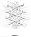 Fig. 08 - Clinical and surgical system and method for moving and stretching plastic tissue