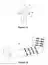 Fig. 11 - Clinical and surgical system and method for moving and stretching plastic tissue