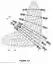 Fig. 12 - Clinical and surgical system and method for moving and stretching plastic tissue