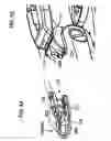 Fig. 43 - Surgical fastener