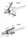 Fig. 46 - Surgical fastener