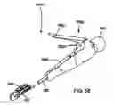 Fig. 52 - Surgical fastener