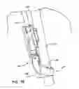 Fig. 63 - Surgical fastener