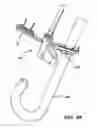Fig. 65 - Surgical fastener