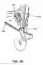 Fig. 69 - Surgical fastener