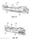 Fig. 71 - Surgical fastener