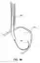 Fig. 74 - Surgical fastener