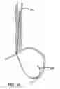 Fig. 75 - Surgical fastener
