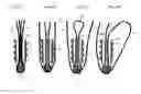 Fig. 16 - Wired sutures