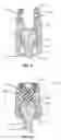 Fig. 07 - Multi-axial screw assembly