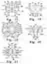 Fig. 09 - BONE PLATE SYSTEM WITH SLIDABLE COMPRESSION HOLES