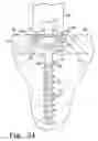 Fig. 12 - BONE PLATE SYSTEM WITH SLIDABLE COMPRESSION HOLES
