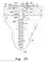 Fig. 13 - BONE PLATE SYSTEM WITH SLIDABLE COMPRESSION HOLES