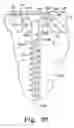 Fig. 14 - BONE PLATE SYSTEM WITH SLIDABLE COMPRESSION HOLES