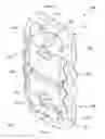 Fig. 02 - Active Settling Plate and Method of Use