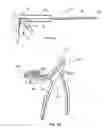 Fig. 07 - Bone screw system and method