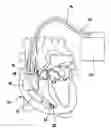 Fig. 01 - IMPLANTABLE MEDICAL DEVICE