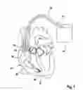 Fig. 02 - IMPLANTABLE MEDICAL DEVICE