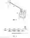 Fig. 02 - Methods and apparatus for treating fibrillation and creating defibrillation waveforms