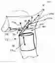 Fig. 01 - Method and apparatus for assisting deglutition