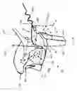Fig. 07 - Method and apparatus for assisting deglutition